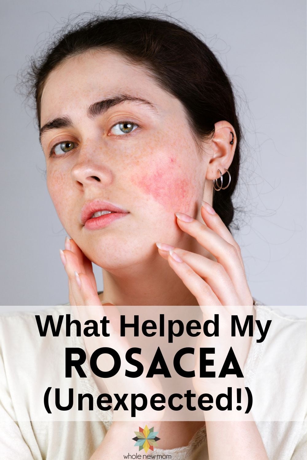woman with rosacea with title saying what helped my rosacea unexpected.
